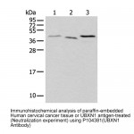 UBXN1 Rabbit pAb (100 μl)