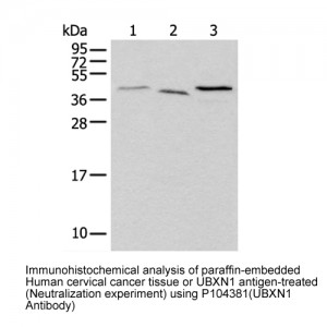 UBXN1 Rabbit pAb (100 μl)