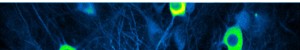 Antibody Labeling Kits