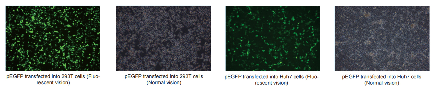 endofree maxi plasmid kit